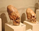 The Experiments on the Skulls From the Paracas Culture